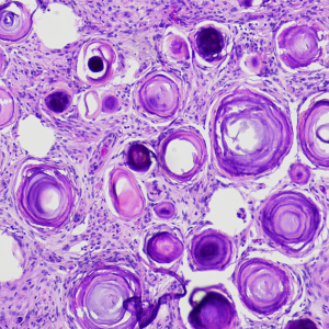 ANATOMICAL PATHOLOGY